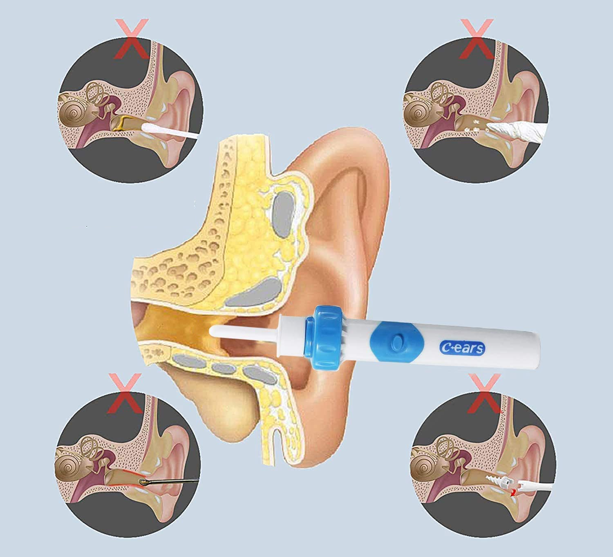 C-EARS electric ear-cleaning device + case and brush