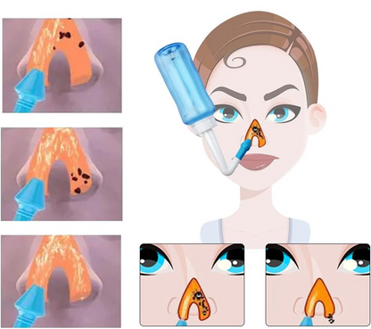 HOUDIAN Neti Pot nasal irrigator