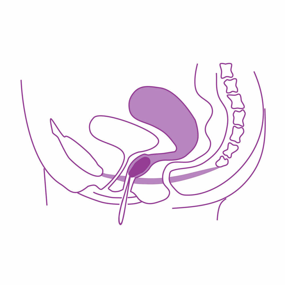 ELANEE phase II intravaginal pelvic floor training insert